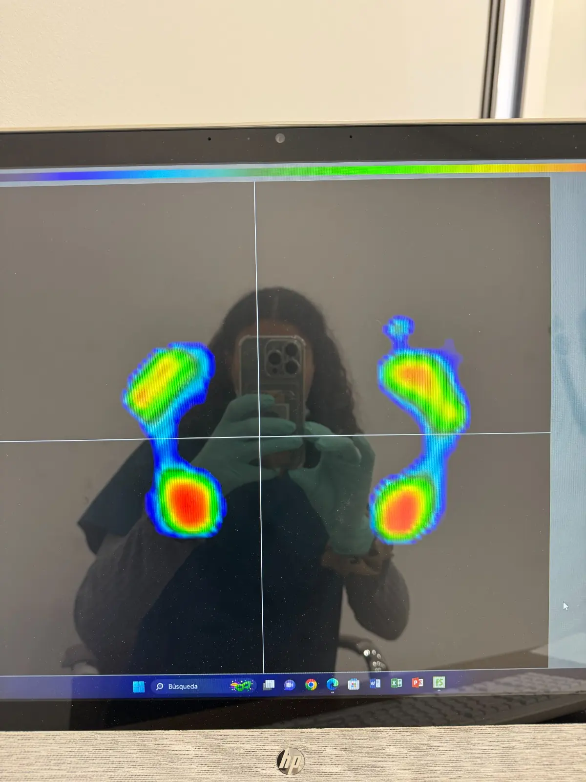 Estudio biomecánico de la pisada con plataforma de presiones en Clínica Indipodo
